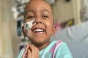 Esha, 4, requires a stem cell transplant to have a chance of survival